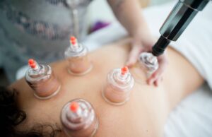Vacuum Cupping