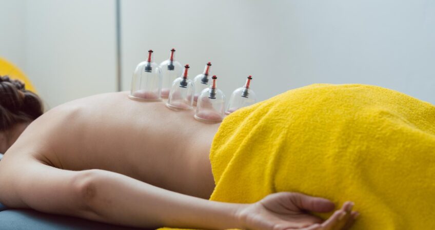 Vacuum Cupping in Herts