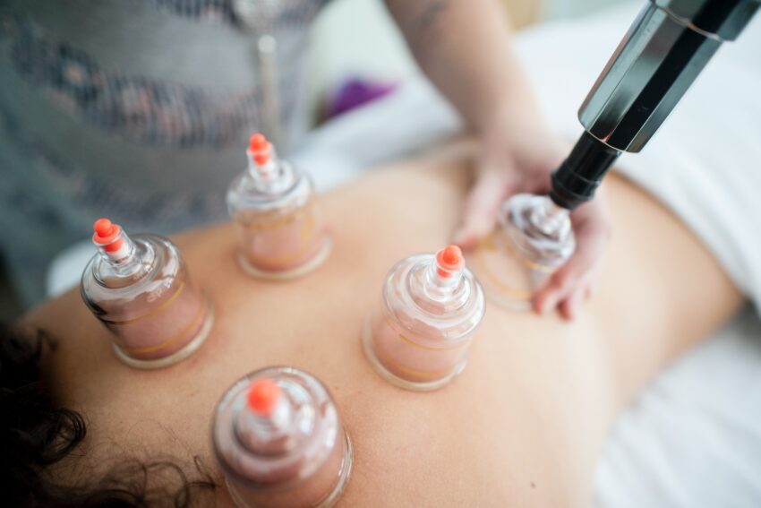 Vacuum Cupping