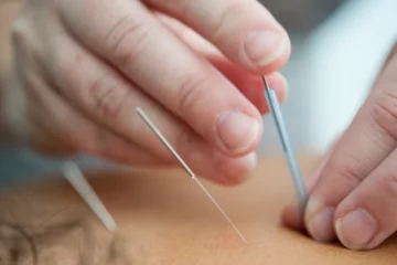 Acupuncture Licensing in the UK: A Step-by-Step Guide