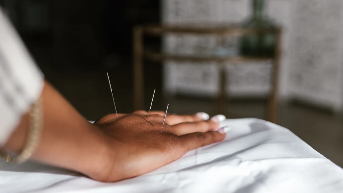 What to expect during a consultation process for medical acupuncture, dry needling & cosmetic acupuncture